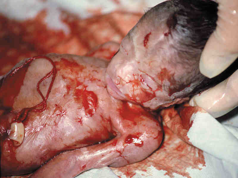 pictures of a 22 week fetus images of 5 week fetus. pictures of a 22 week fetus