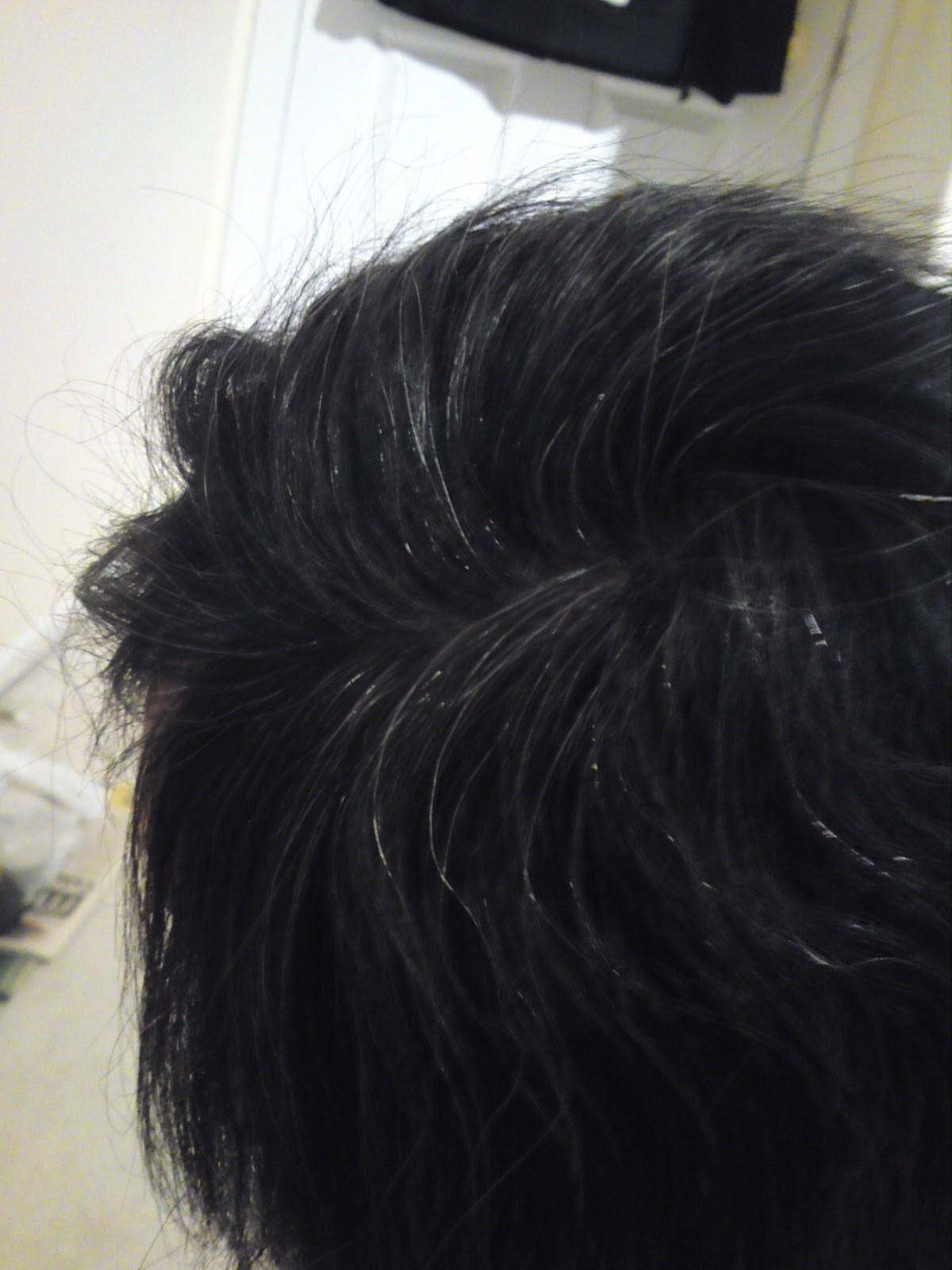 Wink And The World Surprises You Turning White Hair To Black