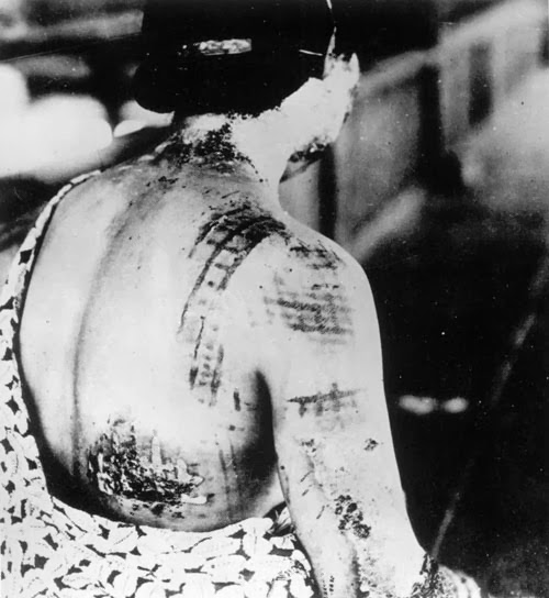 Bombas nucleares de Hiroshima e Nagasaki Bombas nucleares de Hiroshima e Nagasaki
