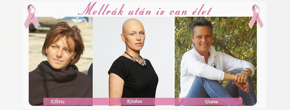 mellrák, emlőrák, mellrák tünetei, mellrák jelei, mellrák ellen