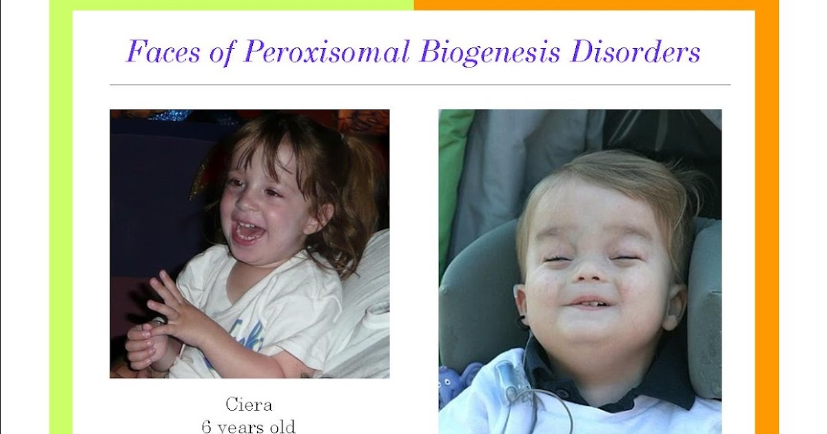 Faces of Peroxisomal Biogenesis Disorders