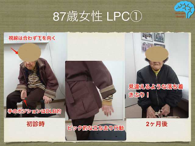 87歳女性LPC。表情や立ち去り行動の改善。