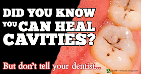 How to Heal Cavities Naturally