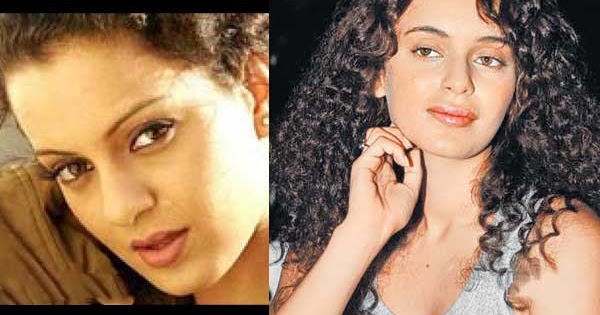 Kangna, Juhi, Koena: Bollywood's plastic surgery disasters! |Alia Bhatt