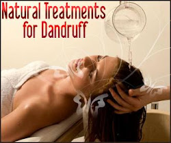 Natural Health Treatments for Dandruff