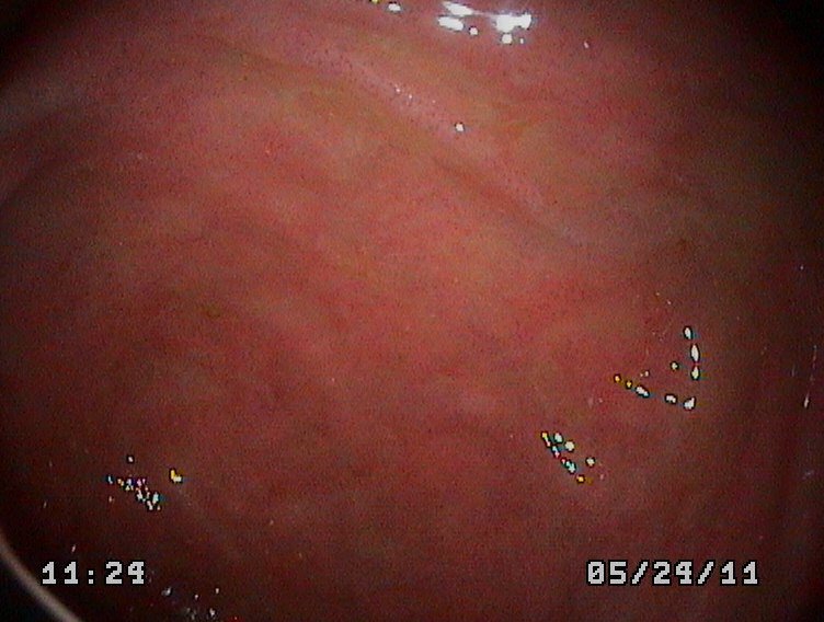 COLONOSCOPIA EN UN PERRO.COLITIS.COLONOSCOPY IN A DOG Cirugía endoscopia veterinaria móvil