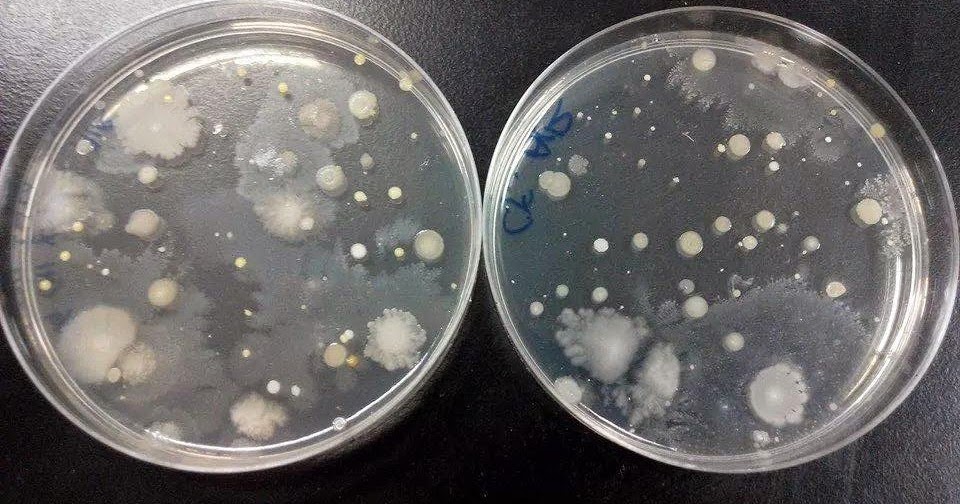 IBG 102 LAB REPORT: LAB REPORT 4 : Sources of Contamination and Infection