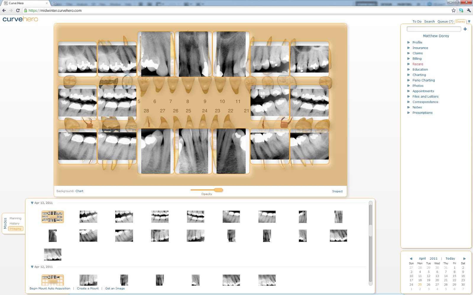 Using Dental Imaging Software mobile captures