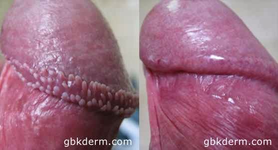This operation is shown to increase member