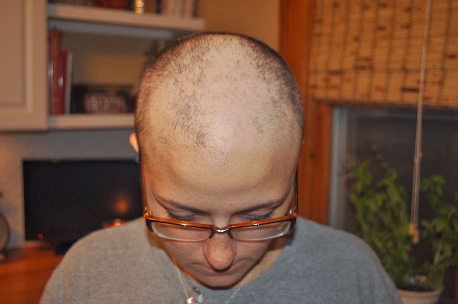 Carri Us Home Chemo 2 & I'm Losing My Mind...and My Hair!