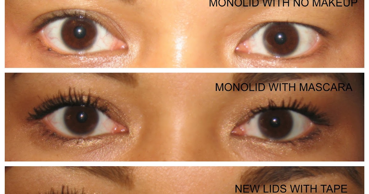 Eye Exercises For Double Eyelid Traumatic Brain Injury And