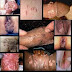 Jual Obat Manjur Untuk Kutil Kelamin thumbnail