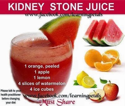 100 apple juice and kidney stones 100 apple juice and kidney stones