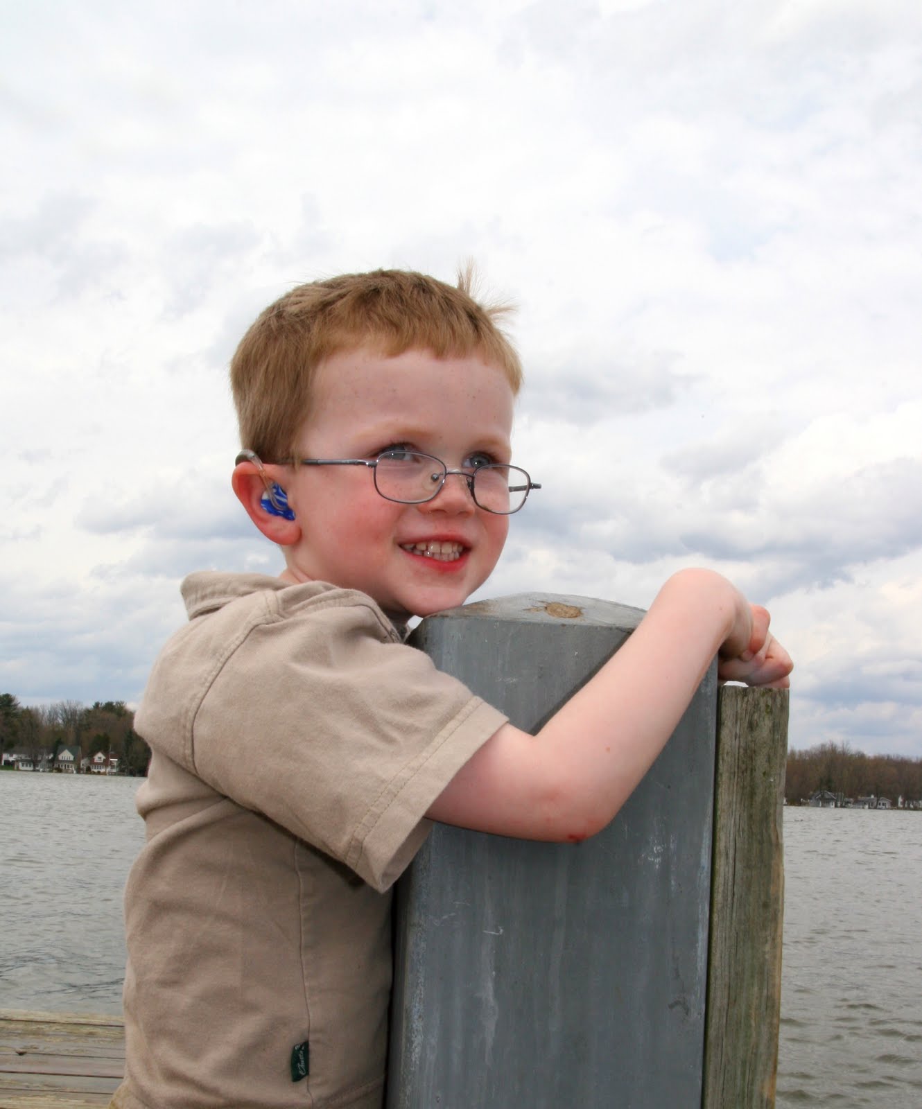 Omeprazole Dosage For Severe Gerd