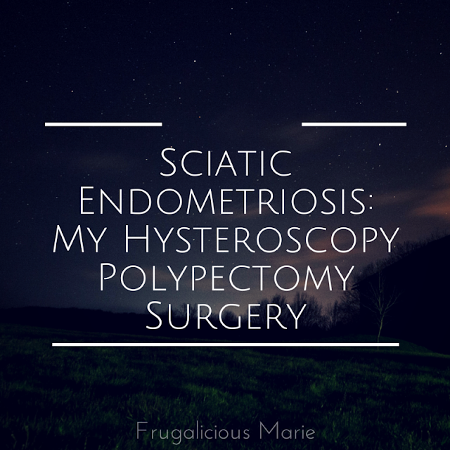 Frugalicous Marie Sciatic Endometriosis My Hysteroscopy Polypectomy
