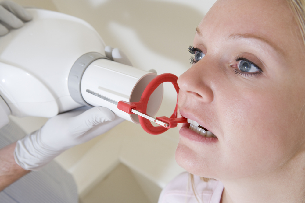 Rosen's Rants Will Dental Xrays Give Me Cancer????