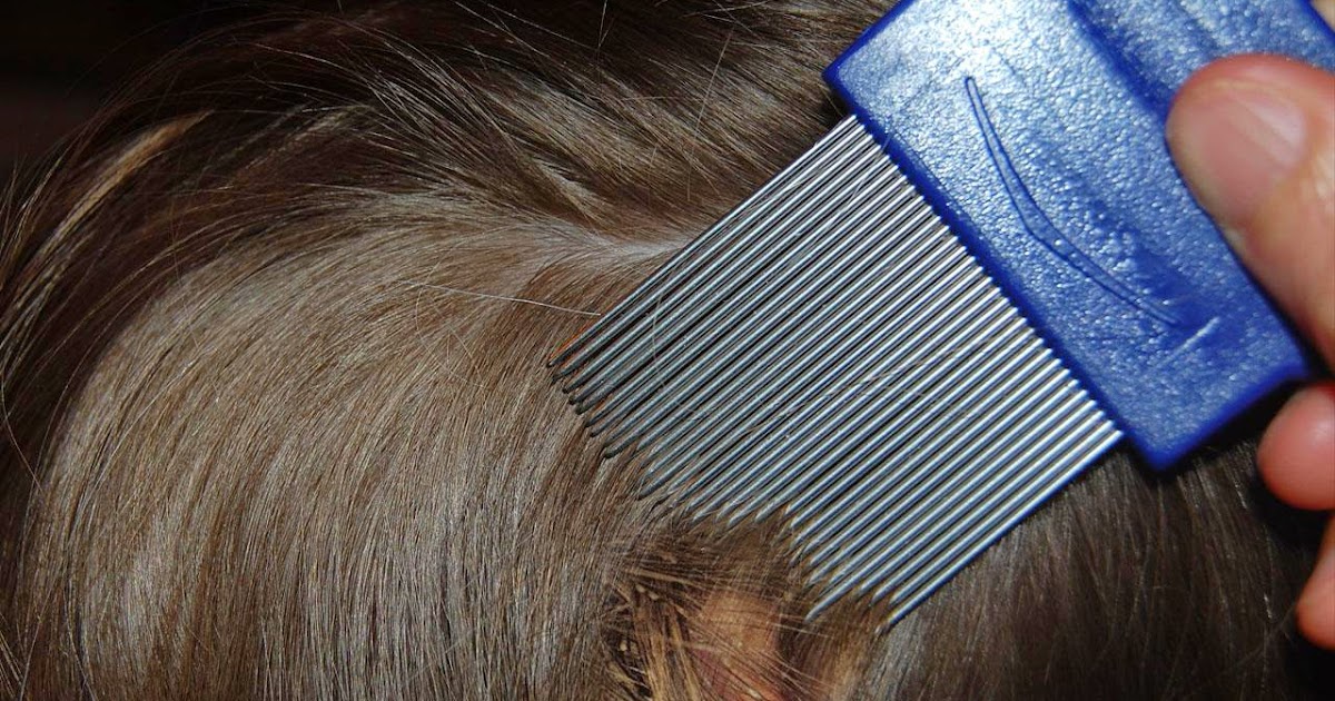 How To Treat Lice Cure Lice With Combs