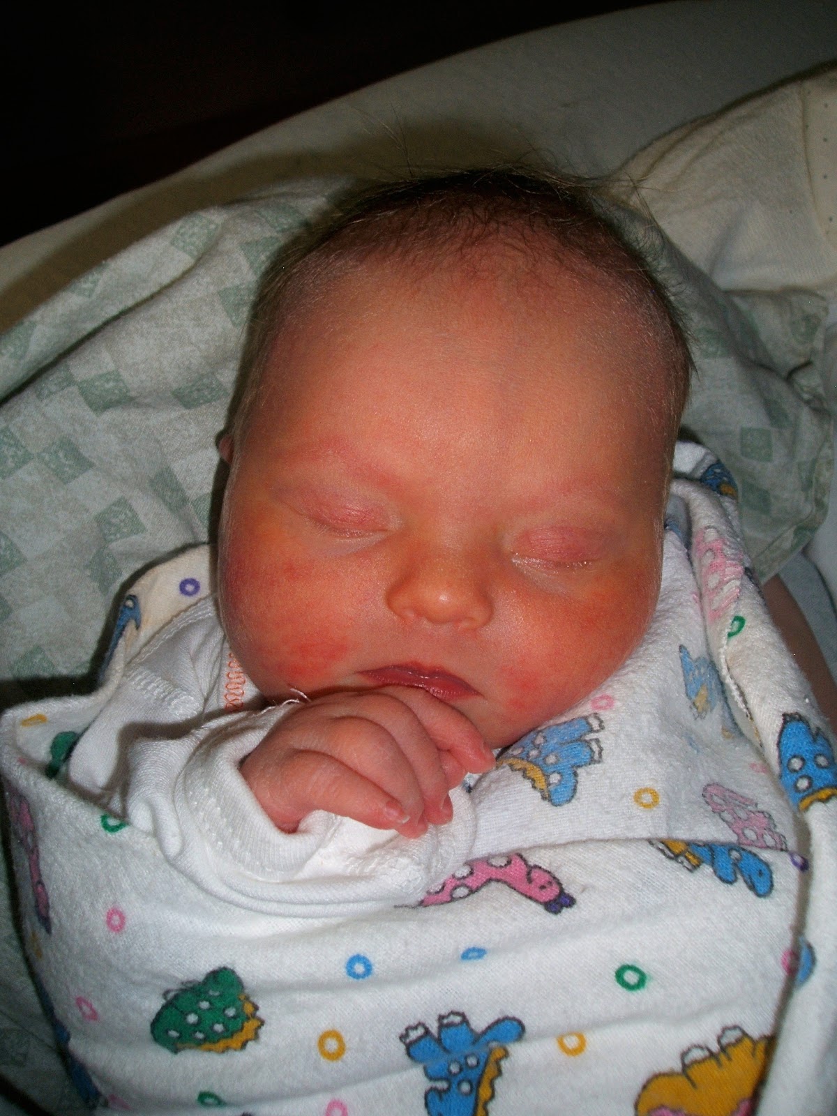 Trisomy 16