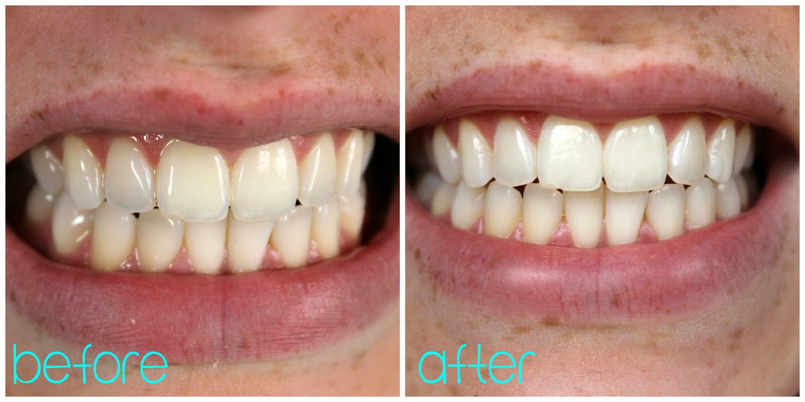 Glazed Over Beauty Up & Up Luminous White Whitening Wraps
