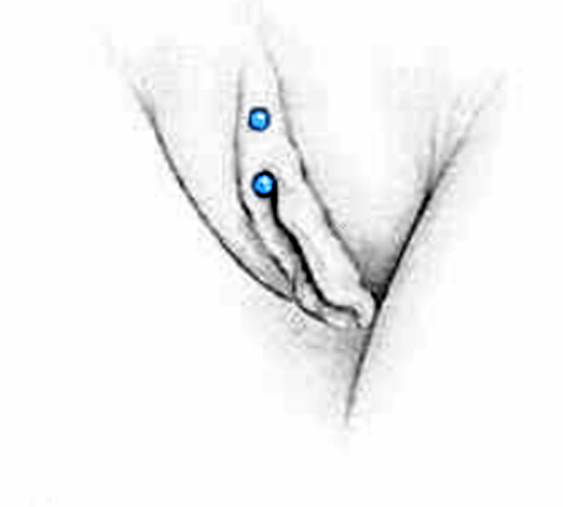 Klitorisvorhautpiercing vertikal pflege