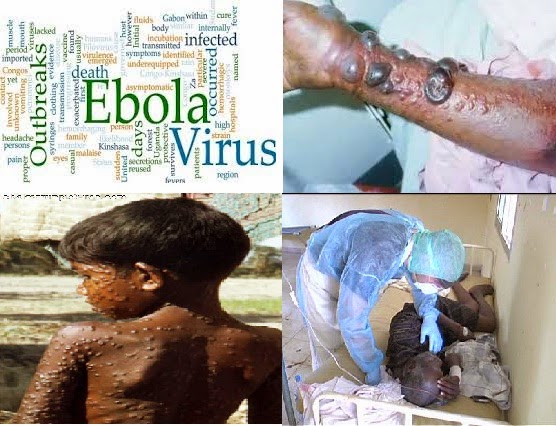 http://3.bp.blogspot.com/-1XVvL2k0mPQ/U9KILX3XtdI/AAAAAAAABYQ/kXEcgbFMtDY/s1600/Hemorrhagic-Fever-Ebola.jpg