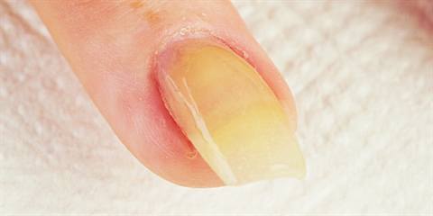 Pro Nail Tech Training: Enhancement Troubleshooting: Yellowing in  Enhancements