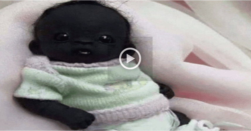 World's Blackest and Darkest Baby went Viral