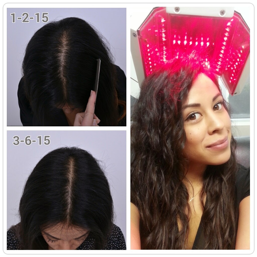 Headlines and Hairlines with Scottsdale Institute for Cosmetic