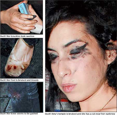 Cultural São Vicente: Amy Winehouse antes e depois das drogas Amy Winehouse