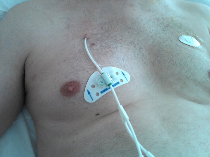 Sean Tiernan Hickman Line Update the good the bad and the ugly