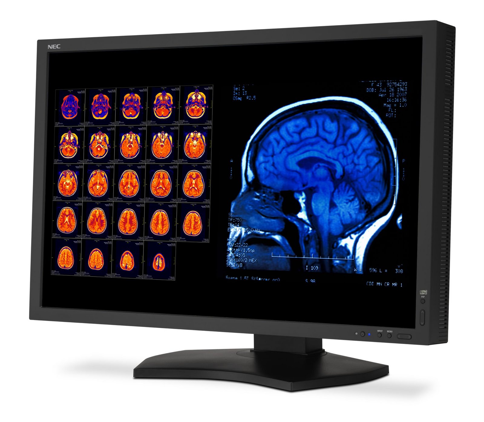 Ampronix Medical Imaging NEC MultiSync MD301C4 Diagnostic LCD Monitor