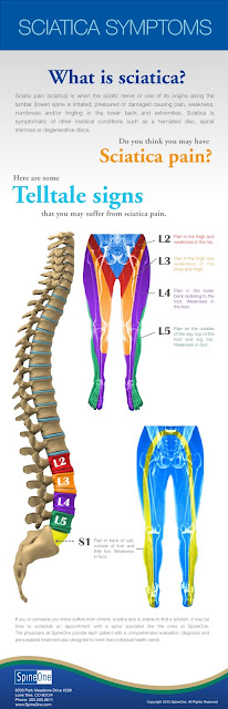  How to Tell if You Have Sciatica