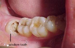 Home Remedy For Dog Tooth Pain Home Remedy For Dog Tooth Pain
