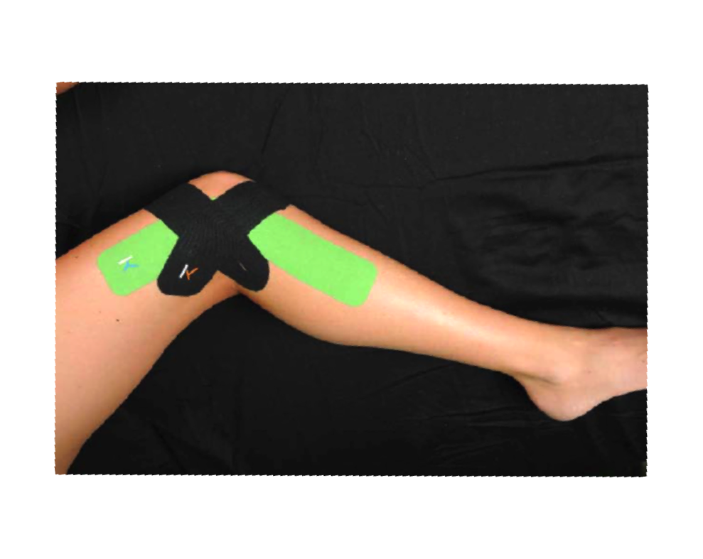 2012 Boston or Bust: Valerie's Marathon Blog: How to self-treat an IT Band: KT  Tape and Sports Massage