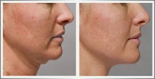 health beauty chin rid double franky kick ass