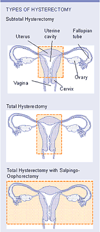 Revisiting My Uterus