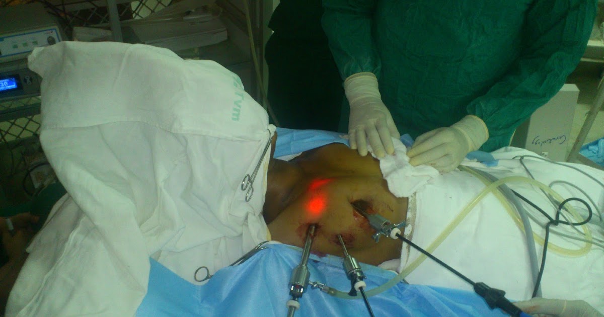 General Surgery Clinics A Surgeon's Blog Endoscopic