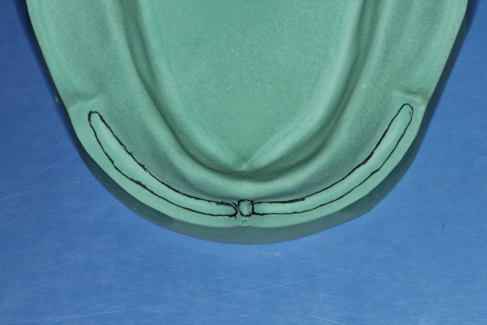 Step by step Guide for Understanding the Prosthodontics Anatomical