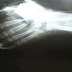 Here Are 23 Facts About Left-Handed People That You Didn’t Know About. The Last One Surprised Me.