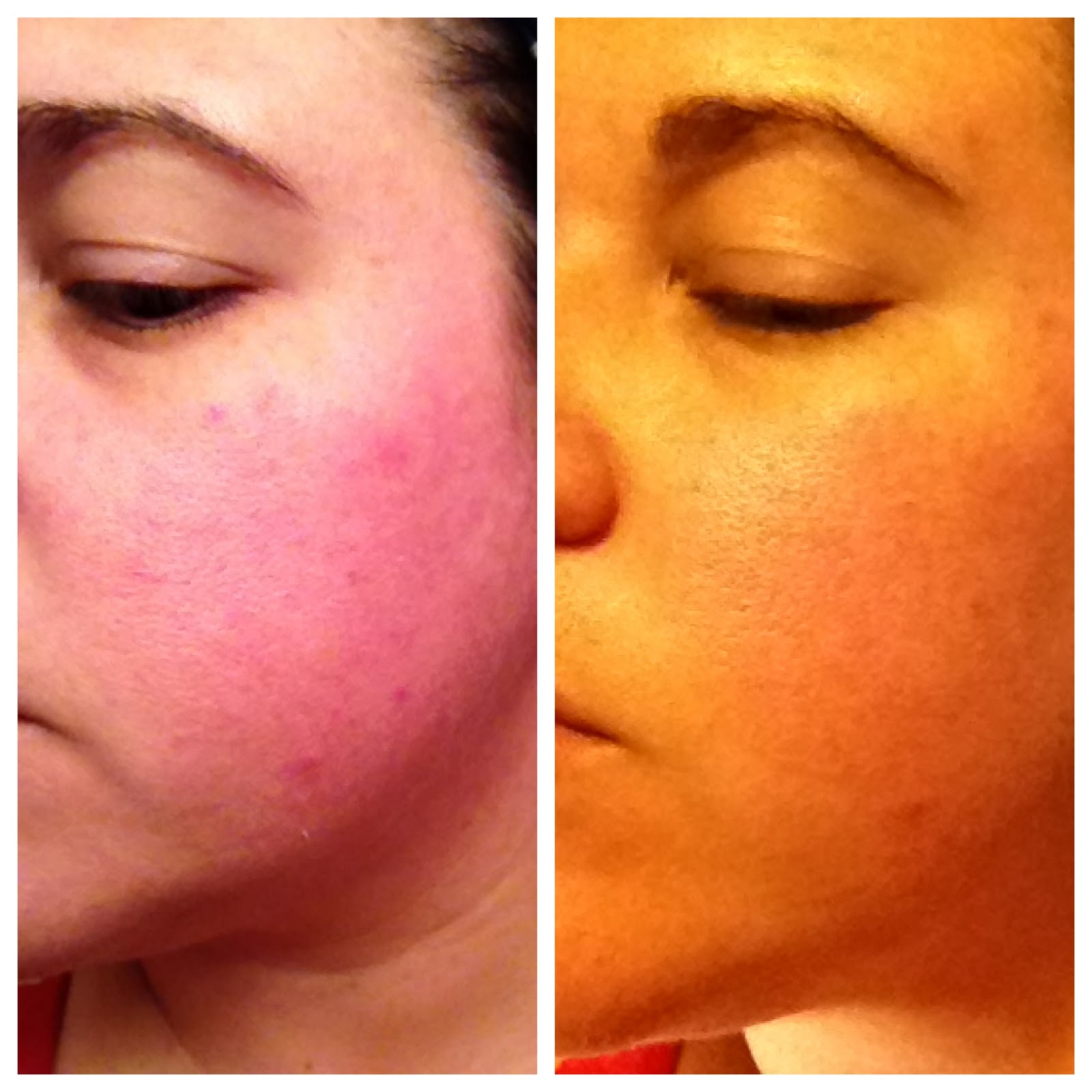 Gross Extra Strength Alpha Beta Face Peel Female Needs