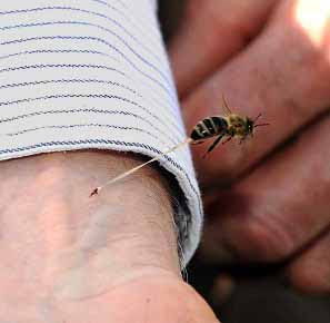 arı sokmasında ne yapılmalı, bee sting