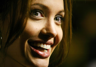 Angelina Jolie Teeth