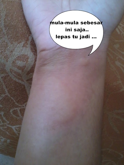 Penah kene `LUDAH HANTU`..