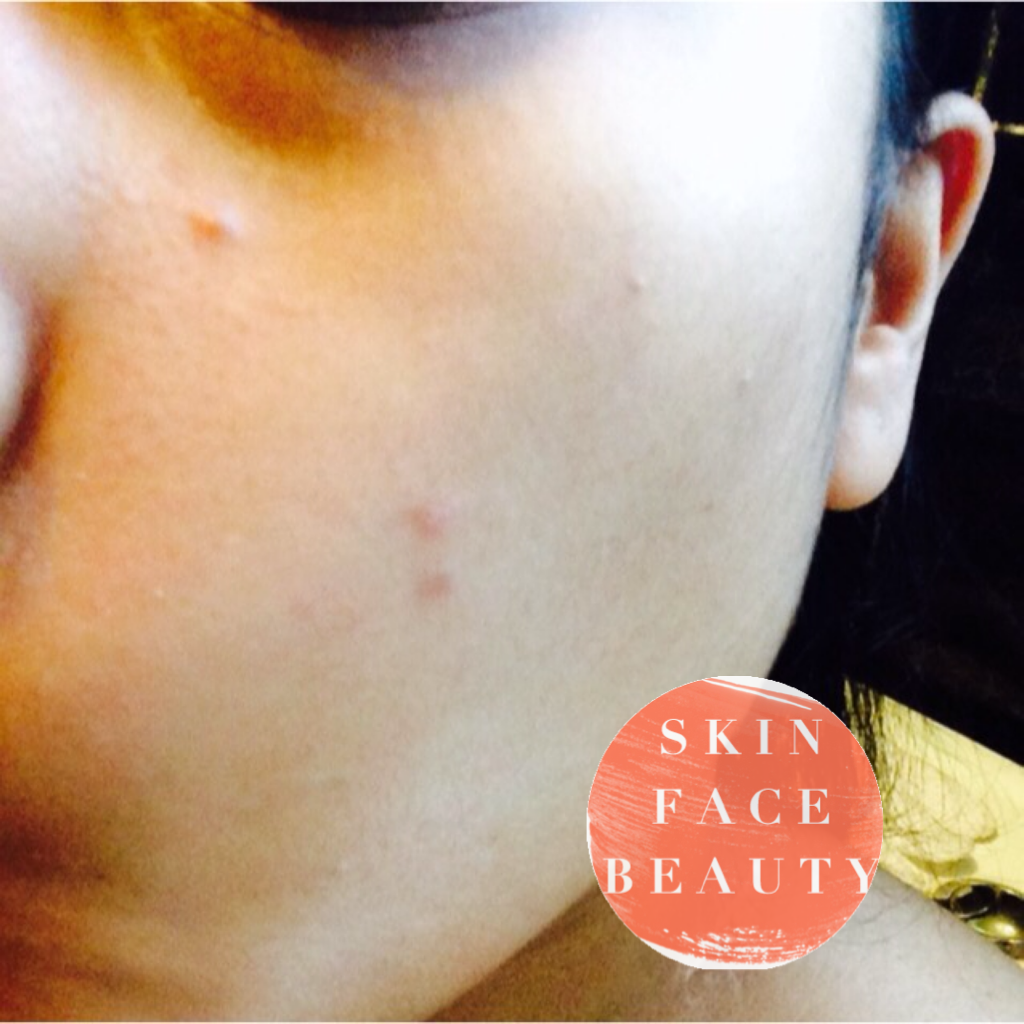 Liz Earle Gentle Face Exfoliator Review — Skin Face Beauty