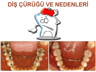 sebebi olmayan sebepler blogger