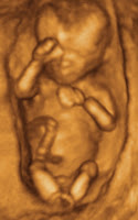 Fetus at 12 weeks