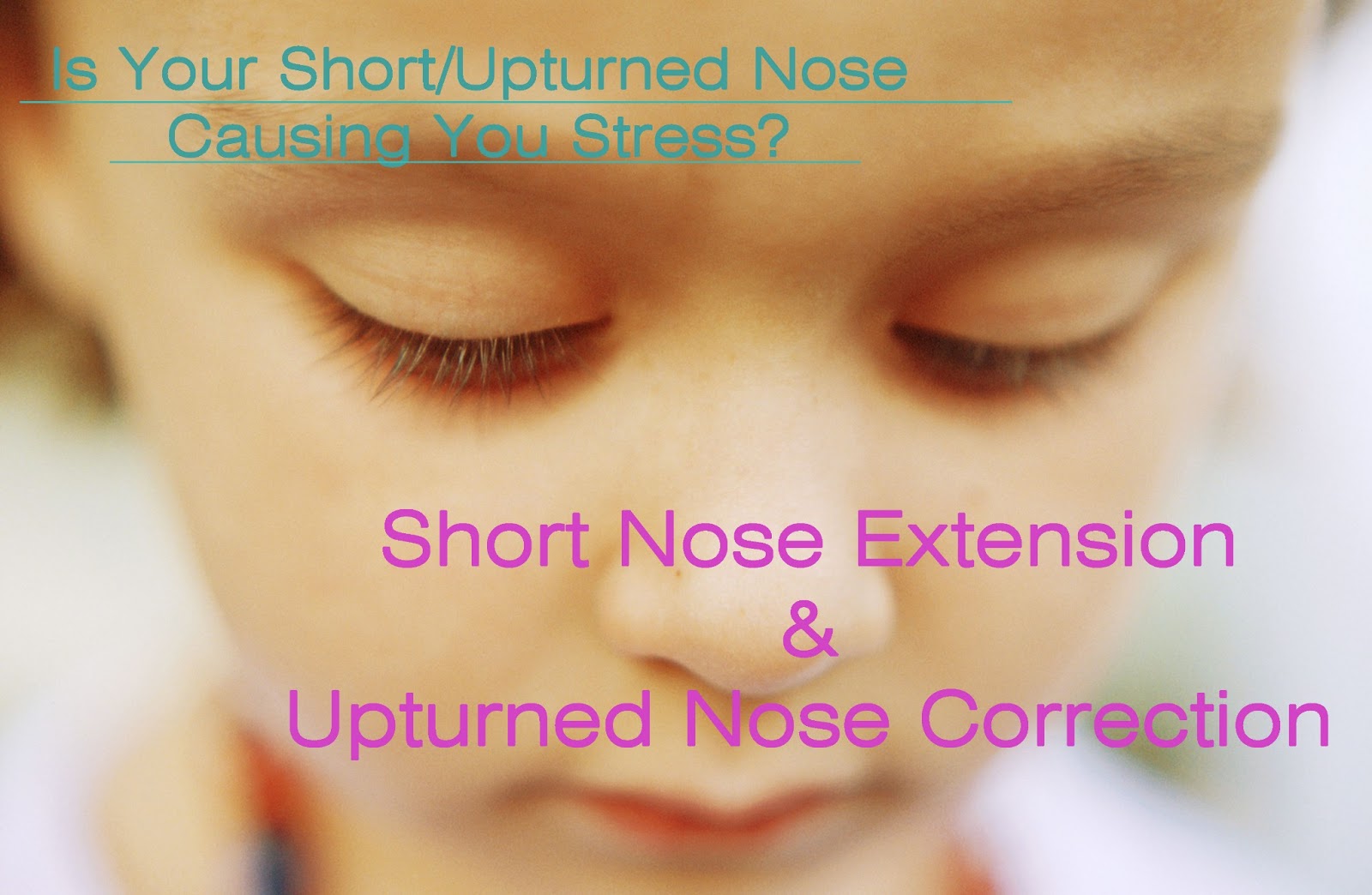 Eyelid Surgery Legend Dr. Kim Byung Gun [BK Plastic Surgery Hospital