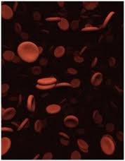 low platelets blood low platelet
