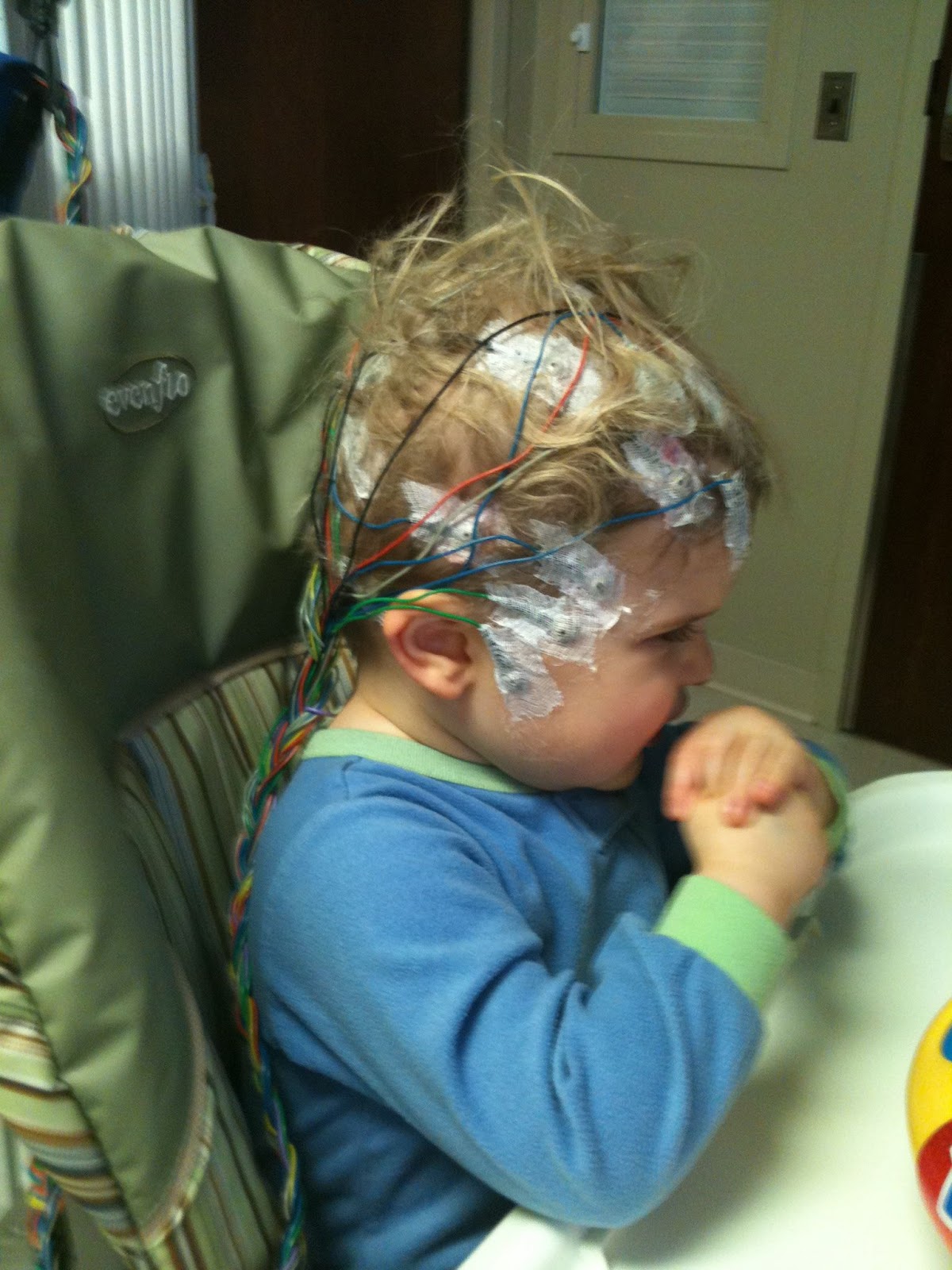 What is an eeg test basicqlero