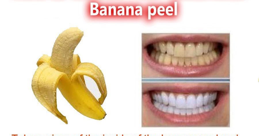 Peel His Banana Porn Videos Pornhubcom